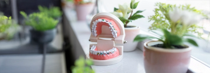 A model of a mouth with braces.