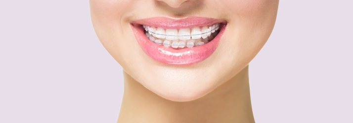 A person wearing clear braces.